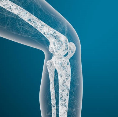 Xray Illustration of Osteoporotic Bone